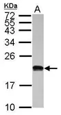 Anti-POLR1D antibody [N1C3] used in Western Blot (WB). GTX115993