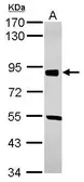 Anti-SOX6 antibody [N1C3] used in Western Blot (WB). GTX116081