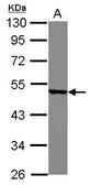 Anti-YBX2 antibody [N2C2], Internal used in Western Blot (WB). GTX116127