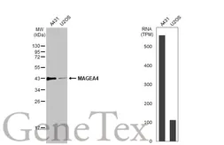 Anti-MAGEA4 antibody used in Western Blot (WB). GTX116357