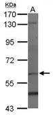 Anti-PAF1 antibody used in Western Blot (WB). GTX116580