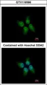 Anti-KLHDC4 antibody used in Immunocytochemistry/ Immunofluorescence (ICC/IF). GTX116586