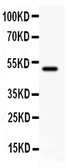 Anti-CD80 antibody used in Western Blot (WB). GTX11680