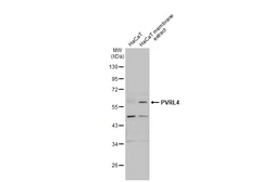 Anti-PVRL4 antibody [N1C1] used in Western Blot (WB). GTX116900