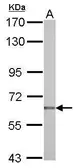 Anti-NUAK2 antibody used in Western Blot (WB). GTX116909