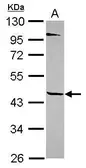 Anti-Tektin 1 antibody [N1C2] used in Western Blot (WB). GTX116922