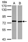 Anti-SCNN1D antibody [N2C2], Internal used in Western Blot (WB). GTX117077