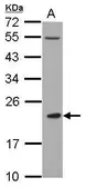 Anti-CLEC4A antibody used in Western Blot (WB). GTX117171