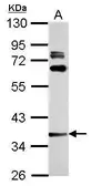 Anti-LAX1 antibody used in Western Blot (WB). GTX117186