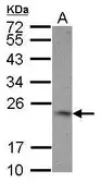 Anti-4-1BBL / CD137L antibody [N2C3] used in Western Blot (WB). GTX117355