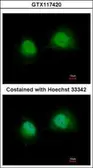Anti-GTF2A1 antibody used in Immunocytochemistry/ Immunofluorescence (ICC/IF). GTX117420