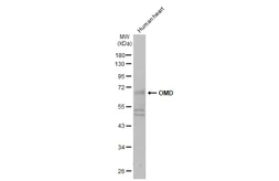 Anti-OMD antibody used in Western Blot (WB). GTX117636