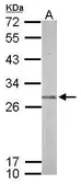 Anti-Proteasome 20S beta 7 antibody [N2C3] used in Western Blot (WB). GTX117690