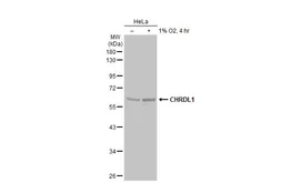 Anti-CHRDL1 antibody used in Western Blot (WB). GTX117884
