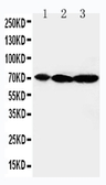 Western Blot（WB）中使用的抗-MEK2抗体。GTX11792型