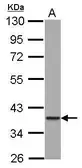 Anti-GIMAP4 antibody used in Western Blot (WB). GTX117992