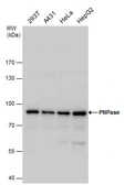 Anti-PNPase antibody used in Western Blot (WB). GTX118737