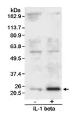 Anti-SOD2 antibody used in Western Blot (WB). GTX11888