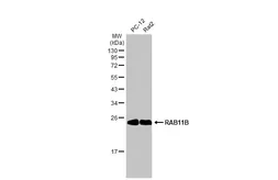 Anti-RAB11B antibody [N1C3] used in Western Blot (WB). GTX119095