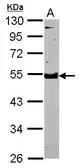 Anti-SPOCK3 antibody [N2C3] used in Western Blot (WB). GTX119149