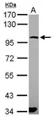 Anti-PCDHGA6 antibody [N1N3] used in Western Blot (WB). GTX119183