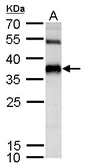 Anti-SPRY4 antibody used in Western Blot (WB). GTX119230