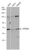 Anti-VPS33A antibody [C1C3] used in Western Blot (WB). GTX119416