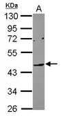 Anti-LILRA4 antibody [N2C2], Internal used in Western Blot (WB). GTX119457