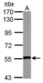 Anti-SMYD1 antibody used in Western Blot (WB). GTX119484
