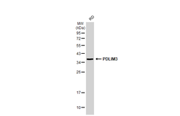 Anti-ALP / PDLIM3 antibody used in Western Blot (WB). GTX119708