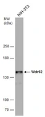 Anti-Wdr62 antibody used in Western Blot (WB). GTX119724