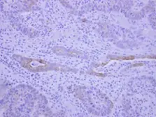 Anti-BEGAIN antibody used in IHC (Paraffin sections) (IHC-P). GTX119786