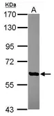 Anti-AGBL4 antibody [N2C3] used in Western Blot (WB). GTX119799