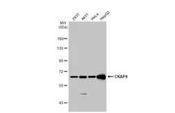 Anti-CKAP4 antibody [N3C3] used in Western Blot (WB). GTX120087