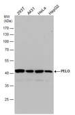 Anti-PELO antibody used in Western Blot (WB). GTX120446