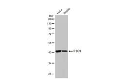Anti-PSG9 antibody [C1C3] used in Western Blot (WB). GTX120479