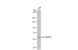 Anti-CHST15 antibody [N3C2], Internal used in Western Blot (WB). GTX120568