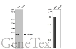 Anti-TRIM41 antibody used in Western Blot (WB). GTX120602