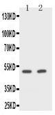 Anti-CD2 antibody used in Western Blot (WB). GTX12099