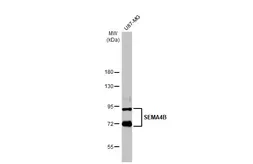 Anti-SEMA4B antibody used in Western Blot (WB). GTX121035