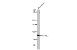 Anti-TTLL7 antibody [N1N2], N-term used in Western Blot (WB). GTX121125