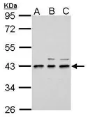 Anti-UPP2 antibody used in Western Blot (WB). GTX121130
