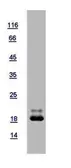 Human REG1 beta protein, His tag. GTX121293-pro