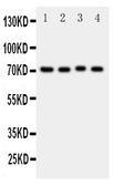 Anti-ABCG2 antibody used in Western Blot (WB). GTX12131
