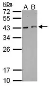 Anti-HEXIM2 antibody used in Western Blot (WB). GTX121524