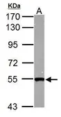 Anti-SMYD1 antibody used in Western Blot (WB). GTX122067