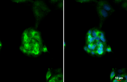 Anti-ASGPR1 antibody [N1C3] used in Immunocytochemistry/ Immunofluorescence (ICC/IF). GTX122674