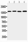 Anti-TJP2 antibody used in Western Blot (WB). GTX12276