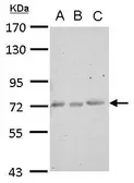 Anti-CERCAM antibody used in Western Blot (WB). GTX123293