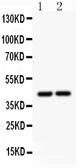 Anti-RUNX3 antibody used in Western Blot (WB). GTX12343